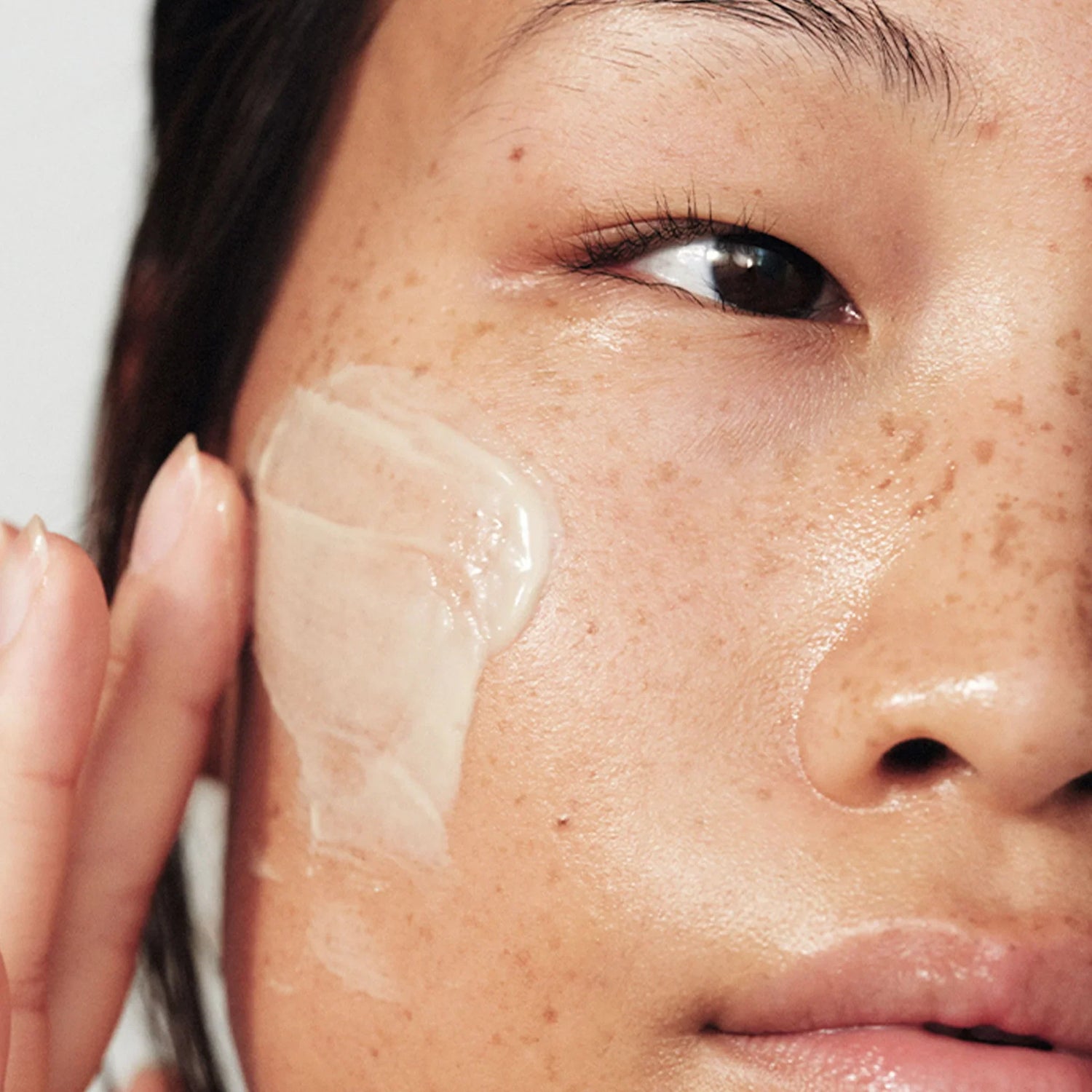 uneven skin tone