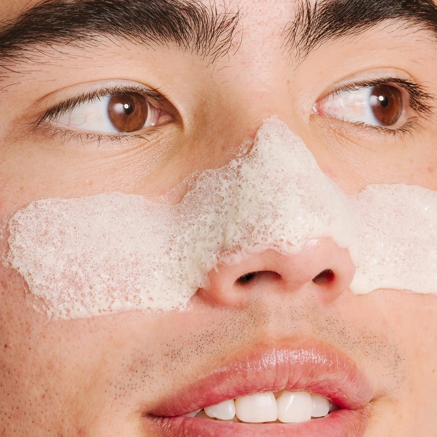 adult acne