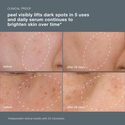 powerbright dark spot system (2 full-size)