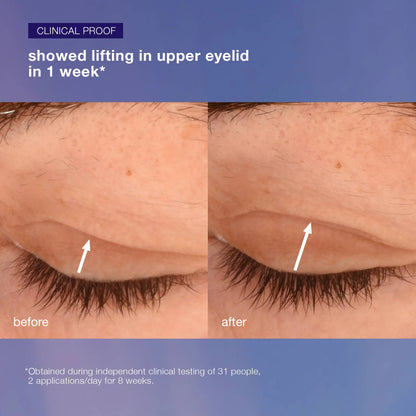 phyto-nature lifting eye cream