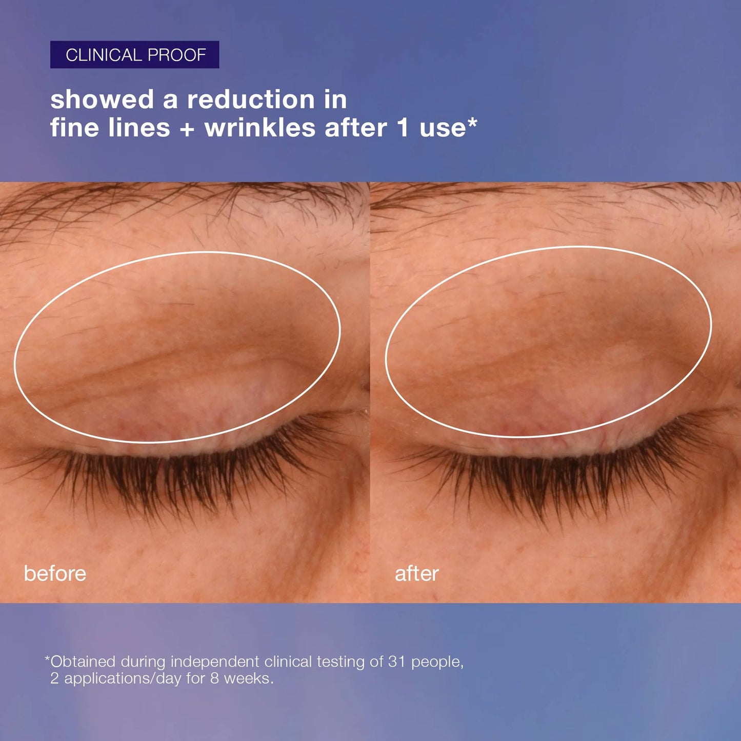 phyto-nature lifting eye cream